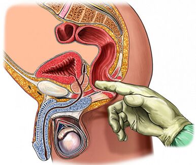 A study of the prostate fingers