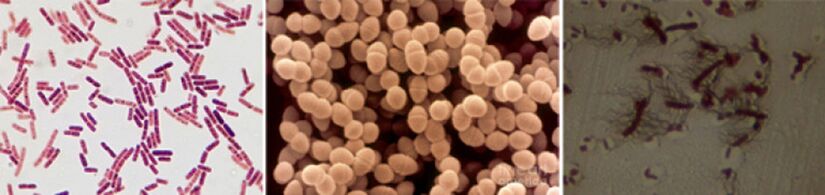 Escherichia coli, fecal enterococci and proteus are the main agents causing chronic bacterial prostatitis.