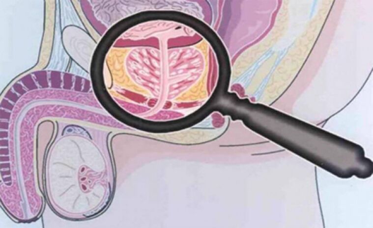 Prostate and its location.